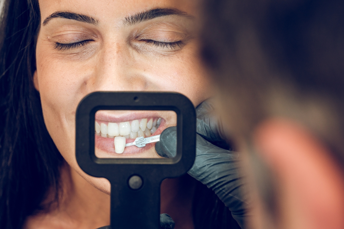 Strengthen Enamel and Improve Bite: Veneers in Utah