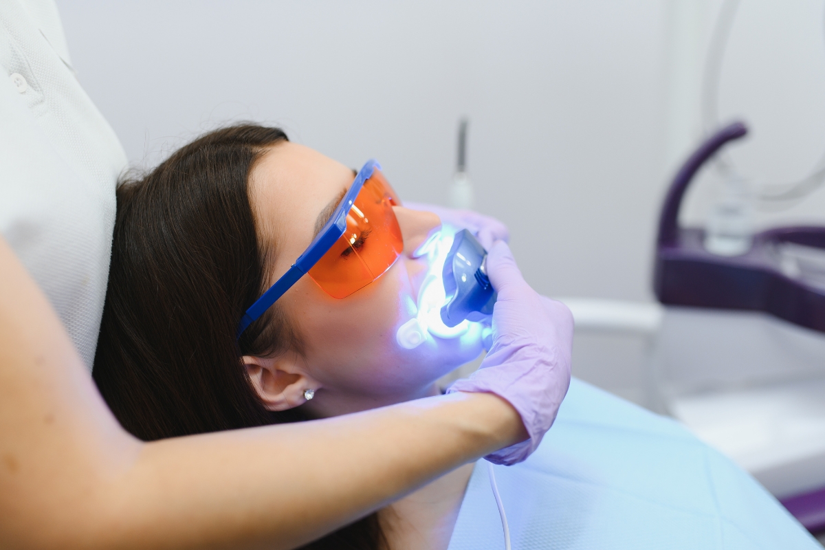 Professional Teeth Whitening vs DIY: Which Is Better?
